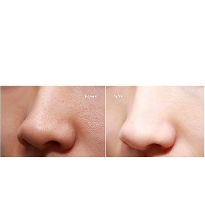 Electric blackhead suction facial cleansing beauty instrument