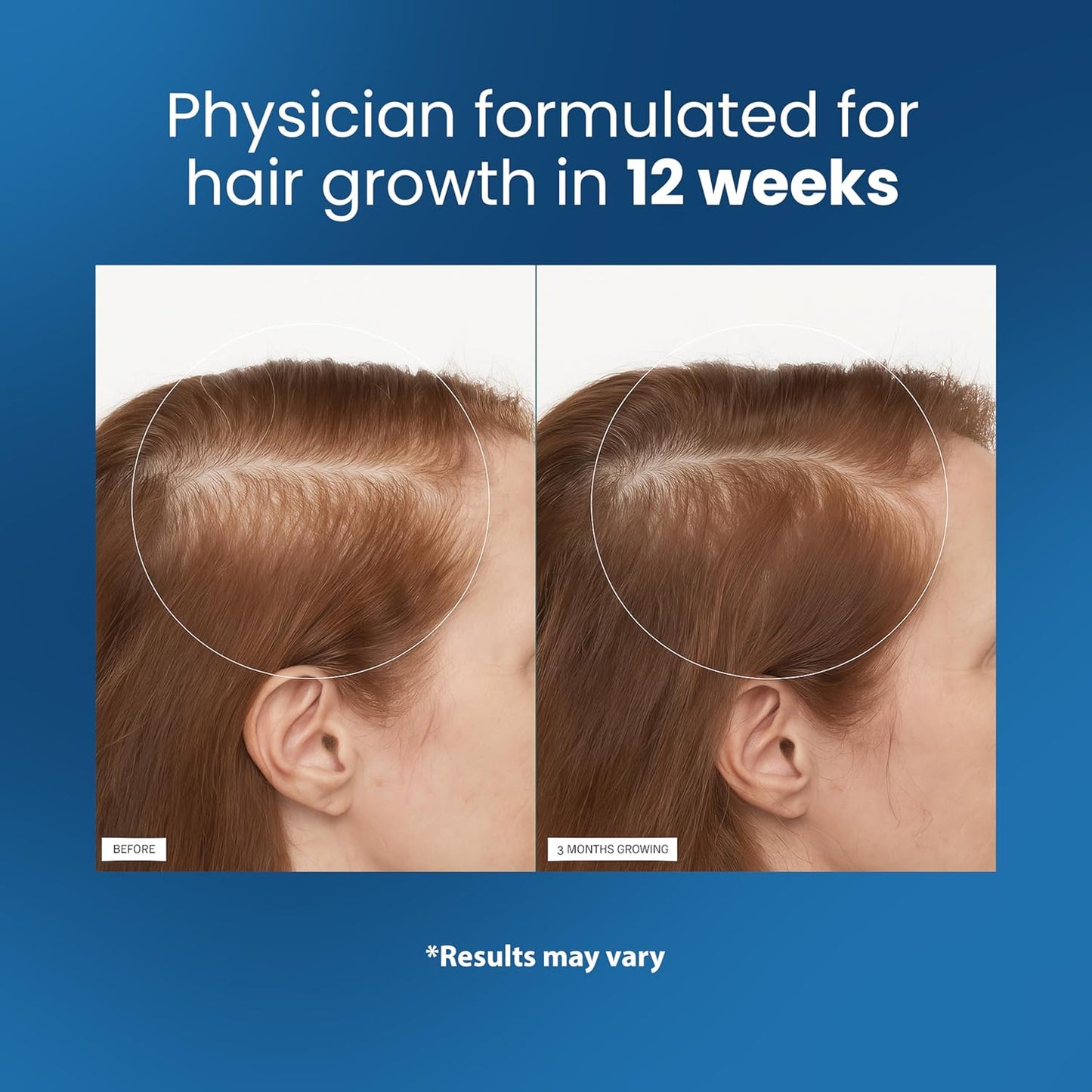 Deep scalp stimulation comb massager for faster hair growth and circulation