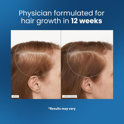Deep scalp stimulation comb massager for faster hair growth and circulation