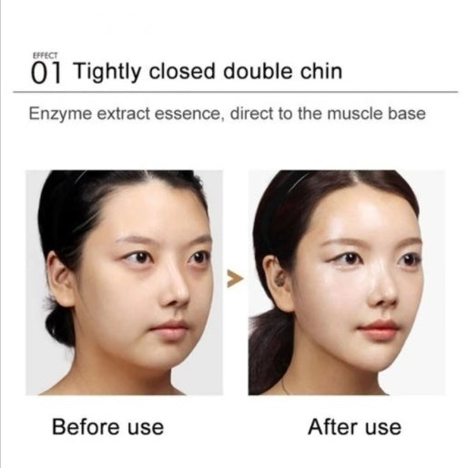 Lifting and moisturizing V-face enzyme firming cream